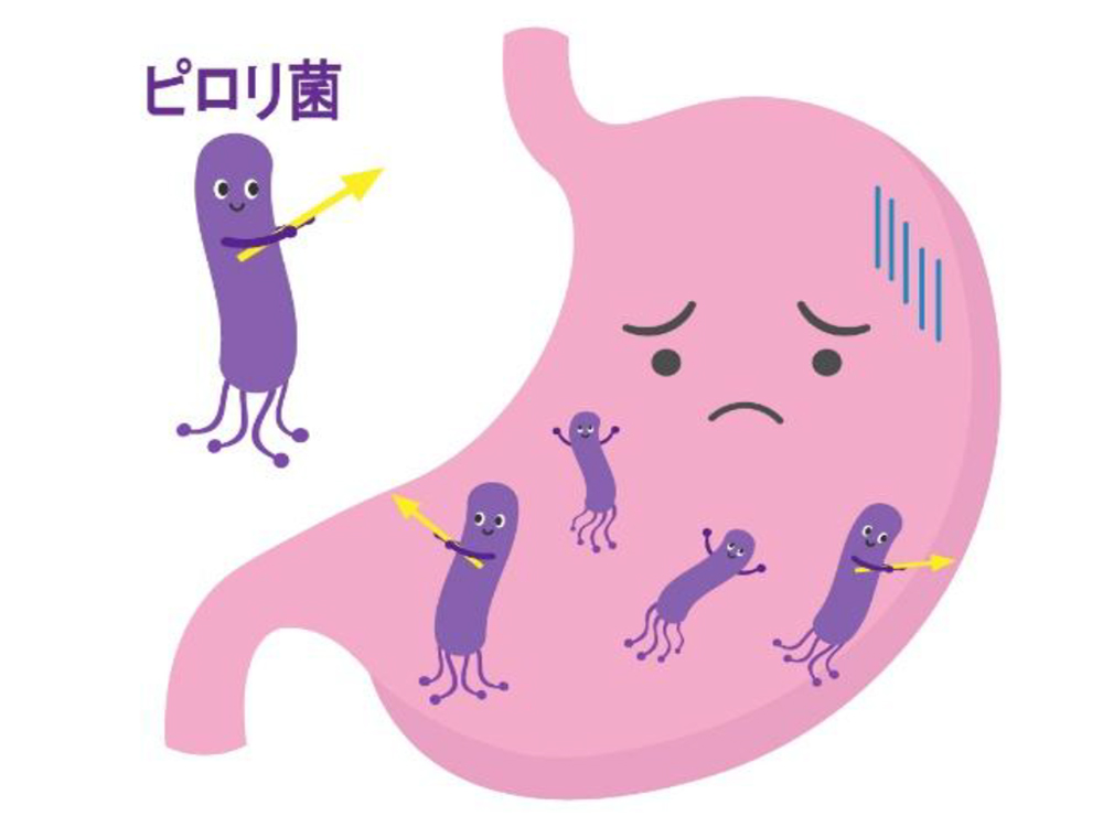 ピロリ菌